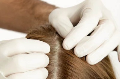 Tips and DIY Scrubs to Have a Healthy Scalp