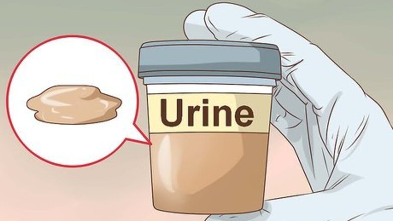 How to Recognize Hepatitis C Symptoms