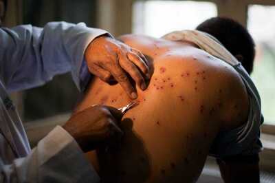 SC Asks Centre to Consider Effective Alternative to Pellet Guns