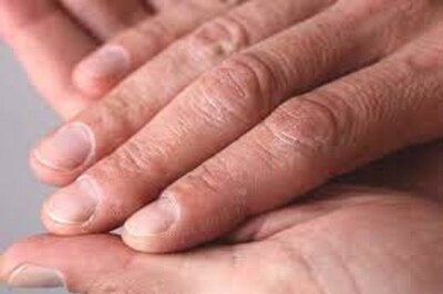 COVID Nails: These Changes to Your Fingernails May Show You've Had Coronavirus