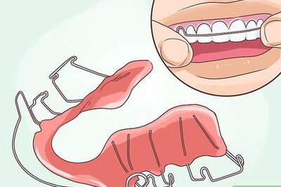 How to Put on a Retainer