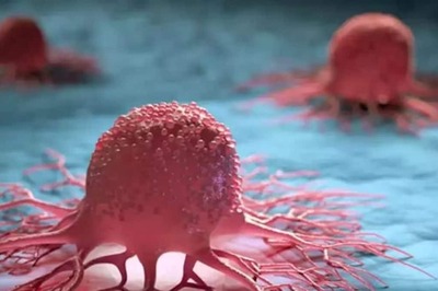 Does Unhealthy Lifestyle Cause Tumours And Cancers? Expert Weighs In