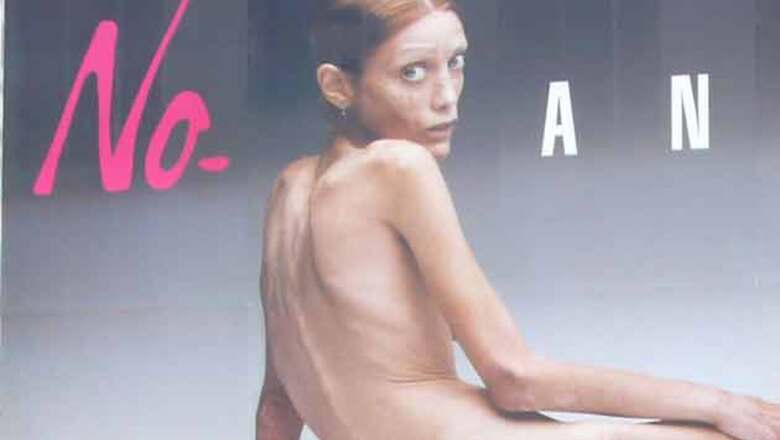 Anorexic French actress and model dies at 28