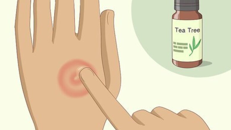 How to Get Rid of Ringworm: Can Natural Remedies Help?