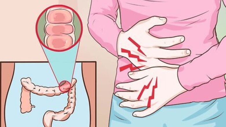 How to Cure Colitis