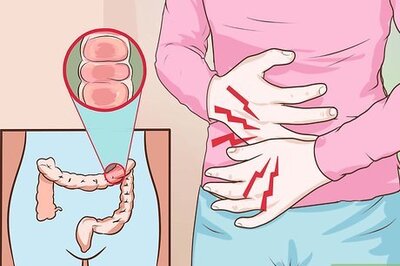 How to Cure Colitis