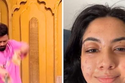 Actress Reem Shaikh Suffers Burns While Shooting For Reality Show Laughter Chefs