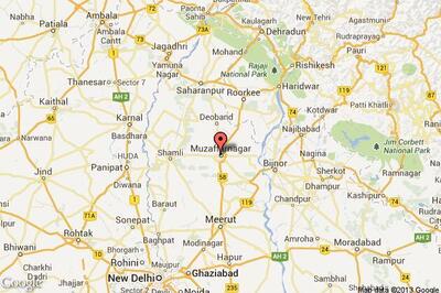 Husband, in-laws throw acid on girl for not getting dowry