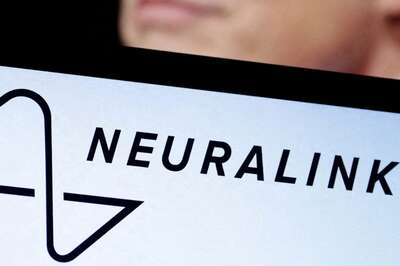 Elon Musk's Neuralink Has Made Its First Human Implant Of The Brain Chip: Here's What He Said