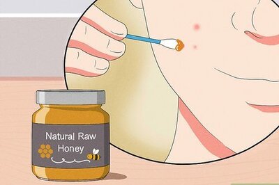 How to Get Rid of Pimple Redness Overnight