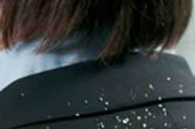 Homeopathy has solutions for dandruff too