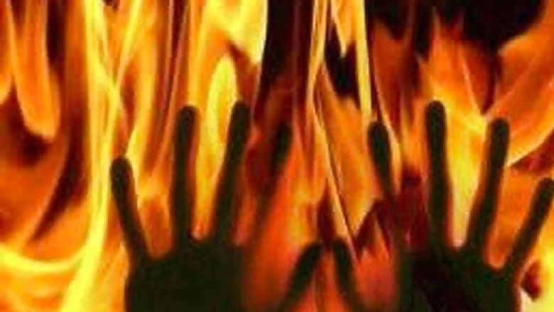 4 Suffer Burn Injuries Following Leakage in Aravana Pipe