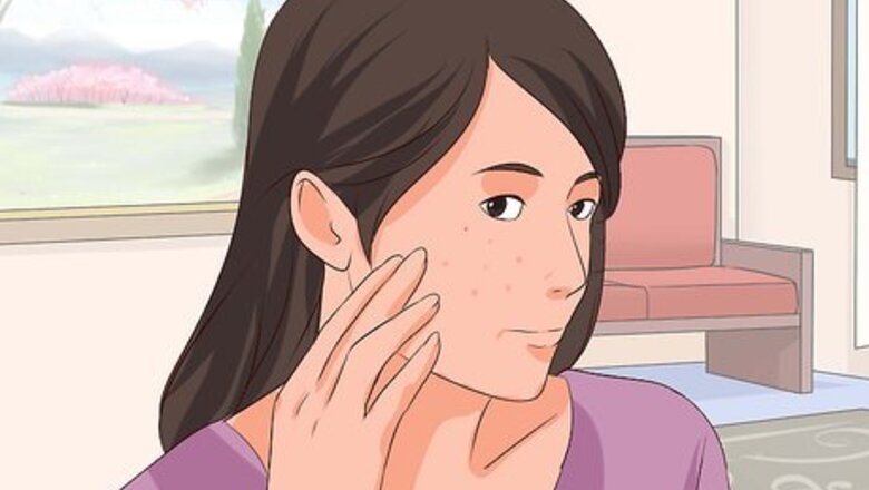 How to Recognize Chickenpox
