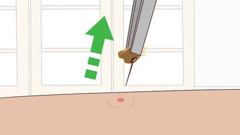 How to Reduce Bug Bite Swelling