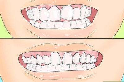 How to Persuade Your Parents to Let You Get Braces