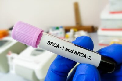 BRCA Gene Testing: Everything You Need To Know About It