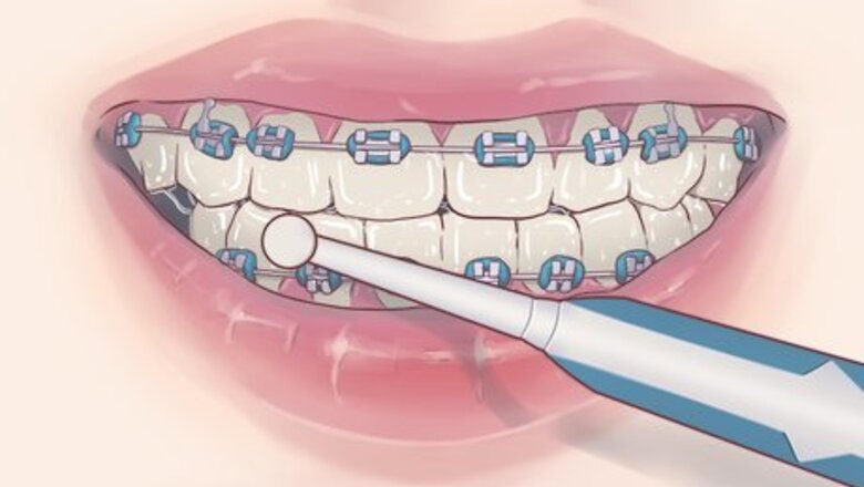 How to Prevent Mouth Cancer