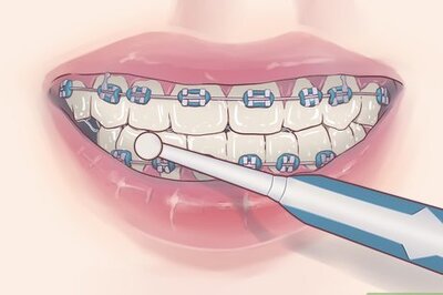 How to Prevent Mouth Cancer