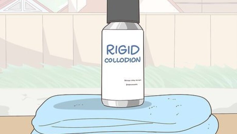 How to Use Rigid Collodion