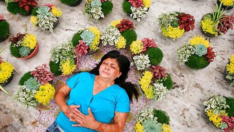 Survivors Of Acid Attacks In Mexico Unite To Push For Change
