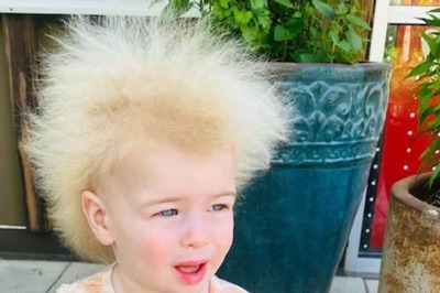 UK Girl Suffers From Rare Condition That Makes Her Hair Uncombable