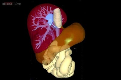 A 3D printer that can create organs at the touch of a button