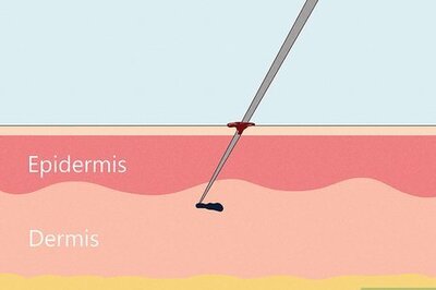 When is Tattoo Bleeding Normal?