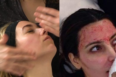 Slap Facial to Vampire Facial: Discover 6 Extremely Weird and Unheard Skin Treatments