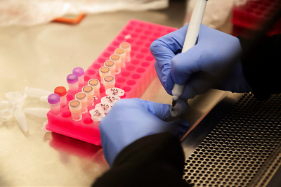 Zinc-hydroxychloroquine Found Effective in Some Coronavirus Patients: Study