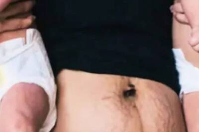 Expert Shares How To Embrace Postpartum Body Changes