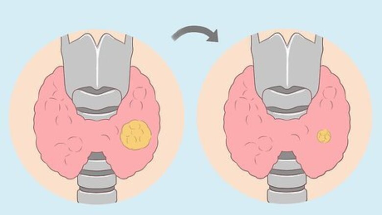 How to Take Lugol's Iodine Orally