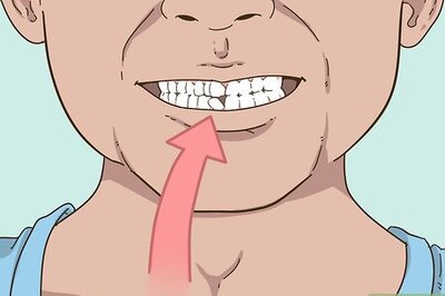How to Painlessly Pull Out a Loose Baby Tooth