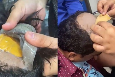 Man Conceals Gold Worth Rs 30 Lakh in Fake Hair, Rectum; Nabbed at Delhi Airport | WATCH VIDEO