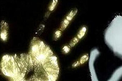 Statements of women with burn injuries to be lodged as FIR