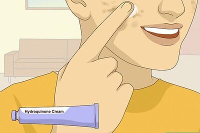 How to Get Rid of Dark Spots on Your Face