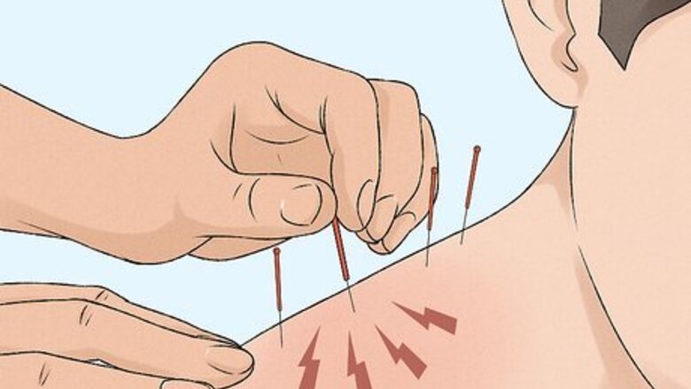 Dry Needling Treatments: Your Most Important Questions Answered