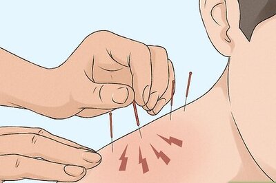 Dry Needling Treatments: Your Most Important Questions Answered