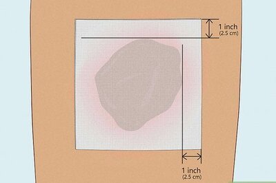 Common Types of Bandages & How to Apply Them