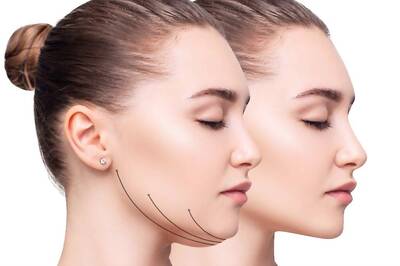 Double Chin: Know The Causes And How Can It Be Treated?