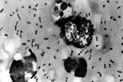 One More Person Dies of Bubonic Plague in Mongolia, 70 People Who Came in Contact with Him to be Tested