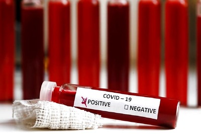 COVID-19 Test Kits in India May See 13x Increase as Serum Institute Invests in MyLab