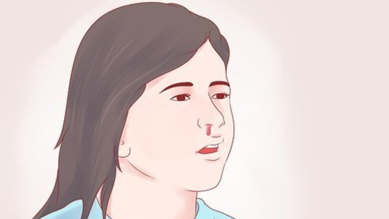 How to Deal with a Toddler Nosebleed
