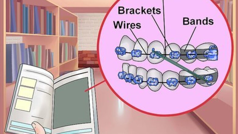 How to Make Braces Look Less Noticeable