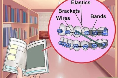 How to Make Braces Look Less Noticeable