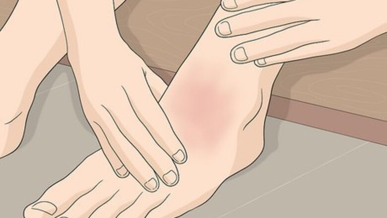 How to Fix Lace Bite With Hockey Skates