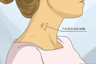 How to Spot a Hickey (8 Telltale Signs)