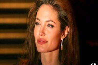 What's hot? Everybody wants Angelina's lips