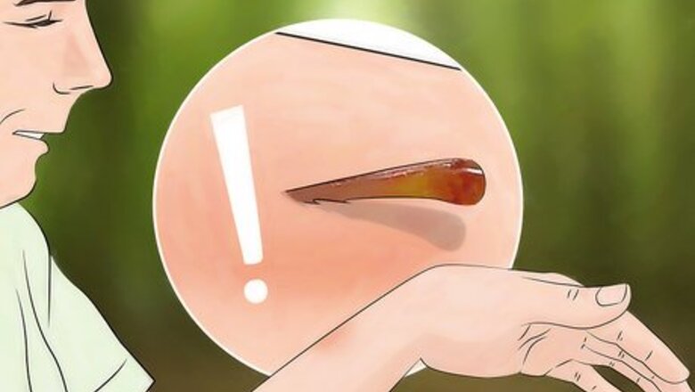 How to Get a Stinger Out