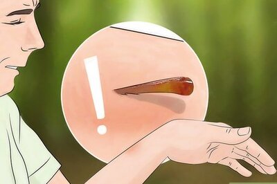 How to Get a Stinger Out