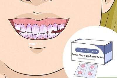 How to Remove Plaque